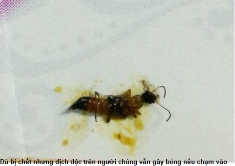 hình ảnh nọc độc kiến ba khoang